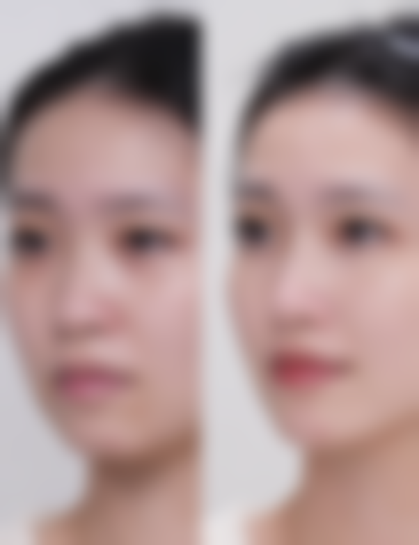 八、深圳星面孔柯思整形医院预约与就诊指引