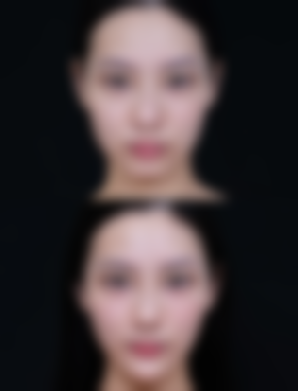 1、主要做的三大诊疗项目