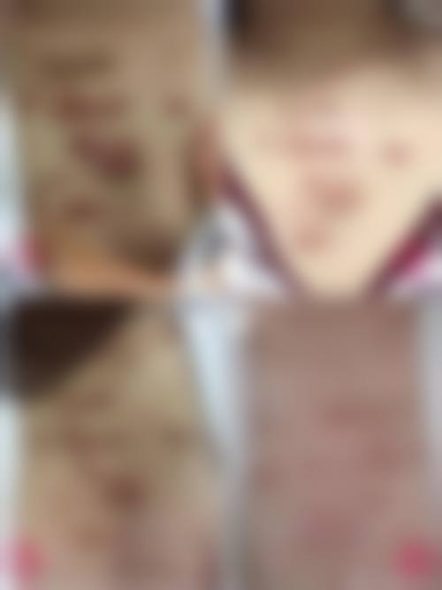 1、主要做的三大诊疗项目