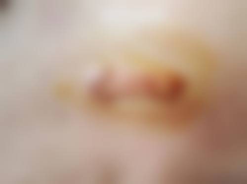 厦门思明碧莲盛医疗美容诊所预约挂号