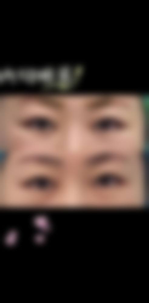 项目作用机制的时间特性与复发风险