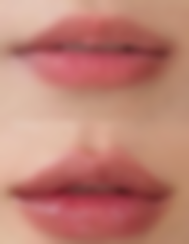 十、相关科普内容推荐:痤疮痘肌综合治疗