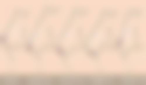 线提升隆鼻安心吗？