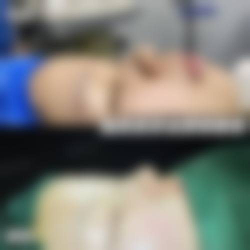 四、台州路桥修复医院整形科收费价格表/收费标准