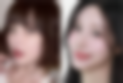 临沂璞愈整形医院正规可靠吗？