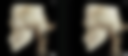 线雕隆鼻的效果如何？效果显著！即刻立体塑形+3000-15000元定价+半年到1年维持，真人案例见证