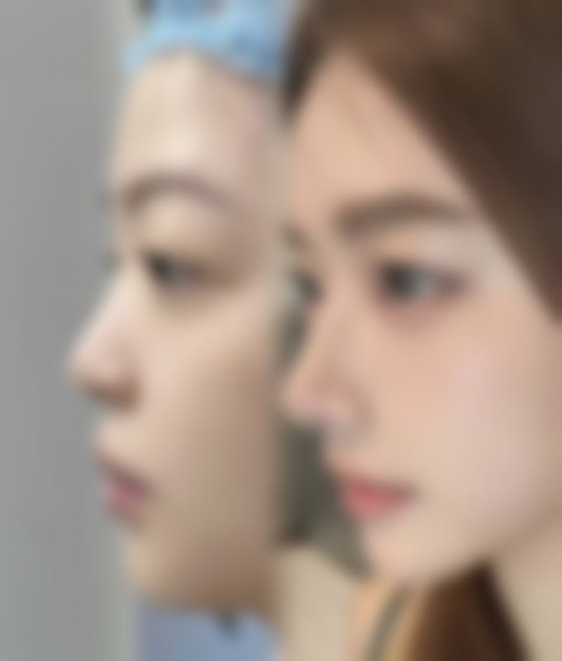 临沂璞愈整形医院预约挂号指南