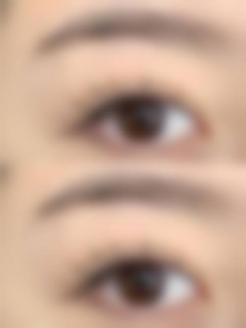 毛发种植的成效稳定性与哪些条件直接相关