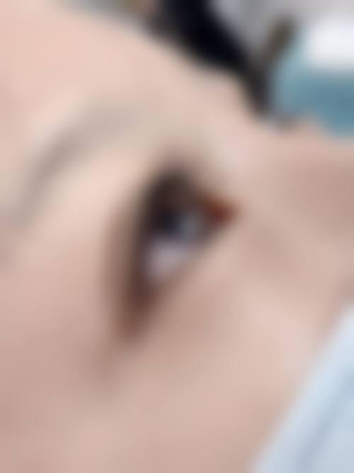 哪些使用场景下毛发种植的成效往往不理想