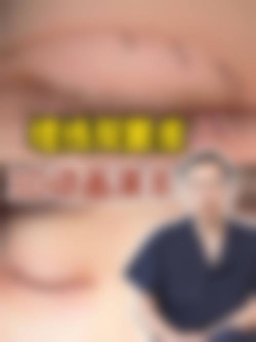 割双眼皮后会不会有后遗症？答案是肯定的！肿胀、瘢痕等8大风险需警惕，选对医院能降低概率