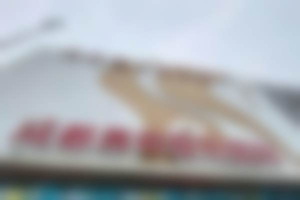 二、邓娟娟医生操刀:内缝单侧小阴唇整形的技术优势与成效