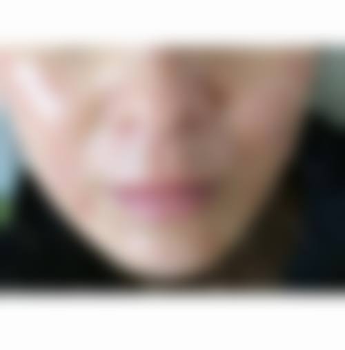 六、北京芭迪星美汇医疗美容诊所种植牙技术优势