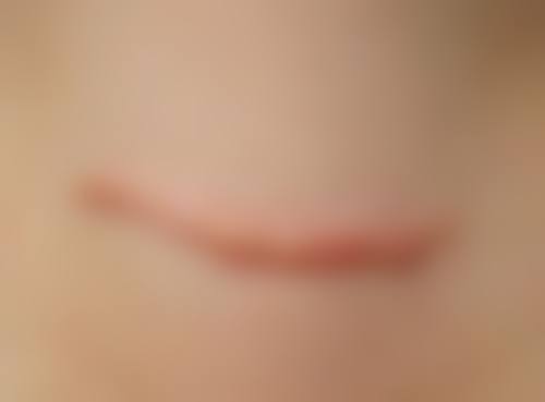 9、长沙美加美容医疗美容诊所预约挂号