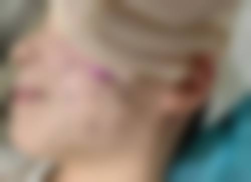 十、成都艾凡加医疗美容门诊部真人口碑实例评价一览