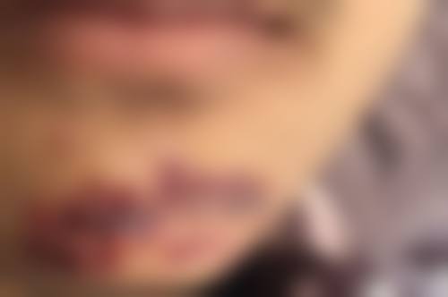 八、深圳和美医院整形美容科口碑好不好?患者诊室评价: