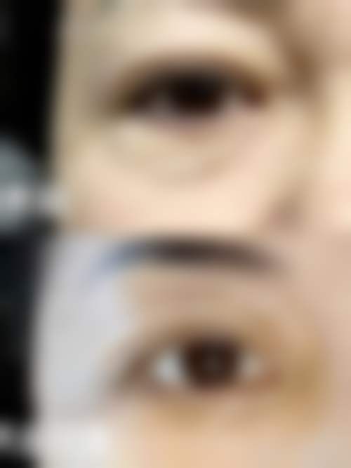 韩国NU整形外科患者常见问题解答（精选 ）