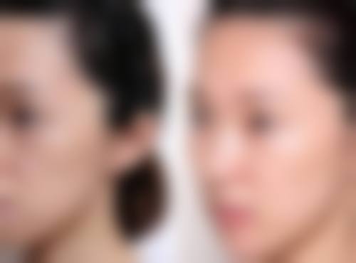 眼霜选购指南:按肤质与眼袋类型适配