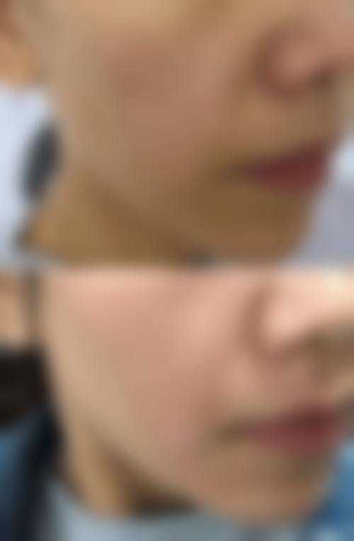 上海宛天医疗美容中 心患者常见问题解答(精选)