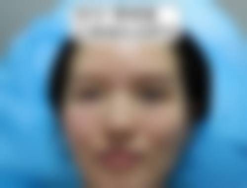 上海宛天医疗美容中 心口碑如何