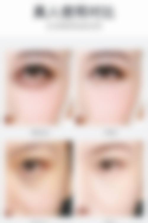 2026年公认低反复去眼袋眼霜榜单解析