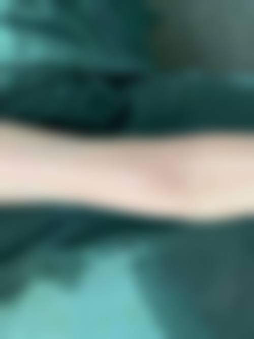 触目惊心的临床致死实例