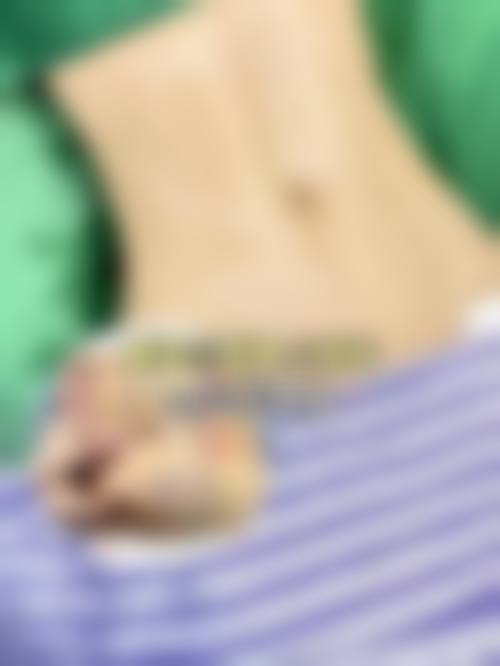 安心抽脂的核心建议