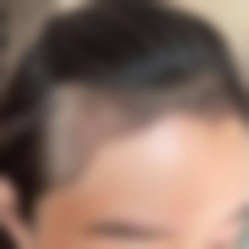 七、聊城青悦整形医院常见问题解答