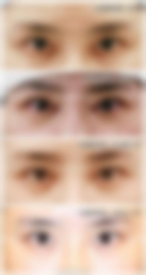 按时睡觉：消除眼袋的成效差异