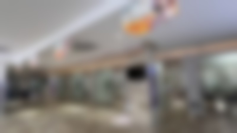 大连爱德丽格刘志刚医生做上睑下垂矫正，术后2个月闭眼双眼皮平整，服务周到 