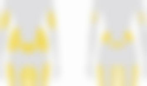 大腿吸脂后修复及变细的阶段性表现