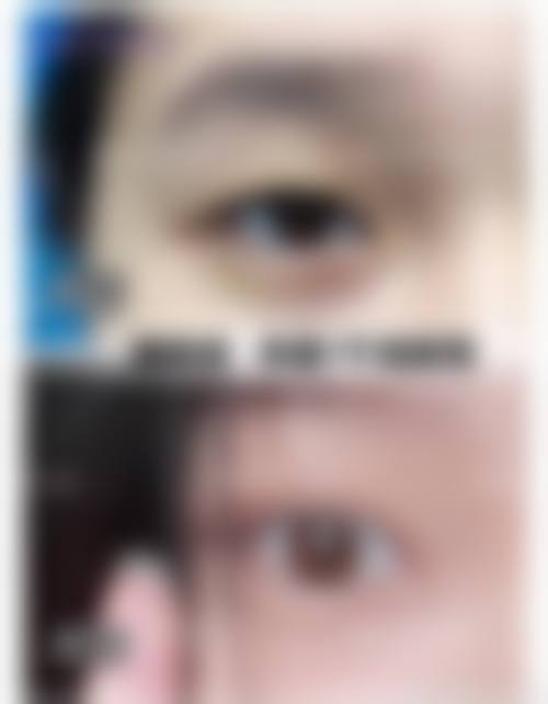 青岛瑧妍美医疗美容医院还有哪些特色项目？