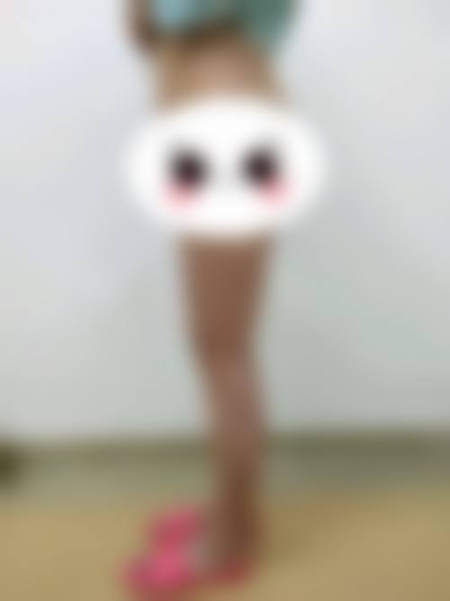 大腿吸脂后多久皮肤能紧致