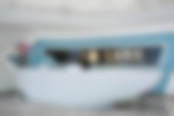 术后1个月！在杭州天鑫医美做快翎线线雕提升，改善苹果肌下垂，已能正常社交 