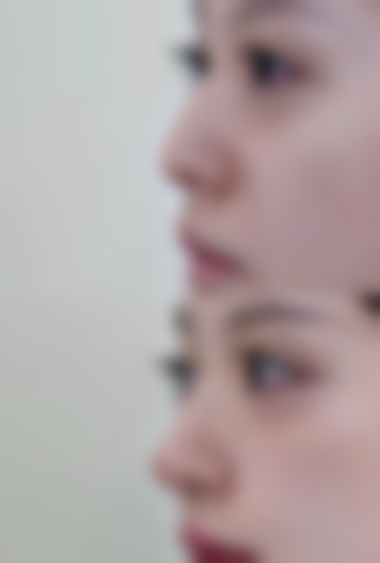 U&LIN整形外科价格表/收费区间参考