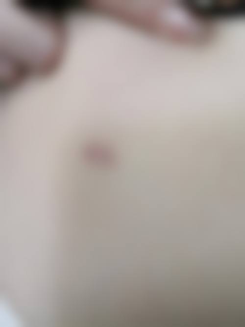 十、昆明茜迪兰医疗美容诊所真人口碑实例评价一览