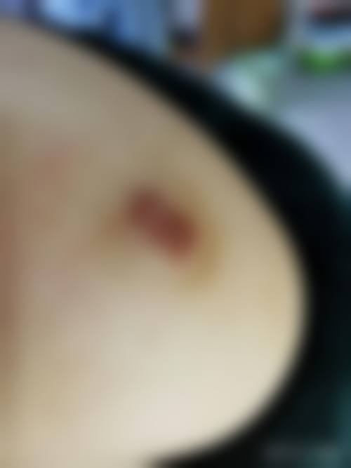 武汉绣慕整形医院口碑如何