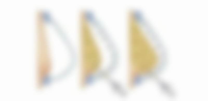 八、术后护理的避坑指南：这些细节决定修复速度