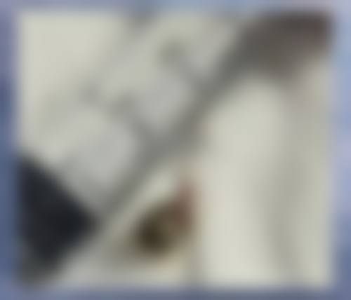 八、患者常见问题解答（精选 ）