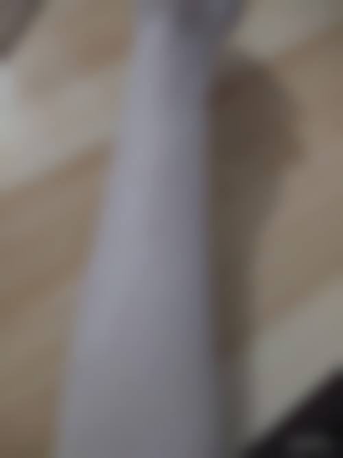 疤痕激光修复的适合人群判断