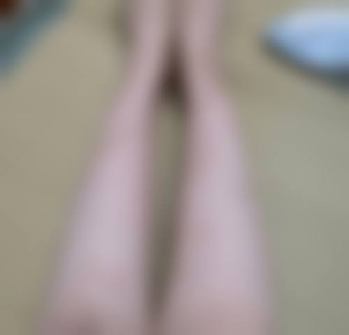 疤痕激光几次能修复回来