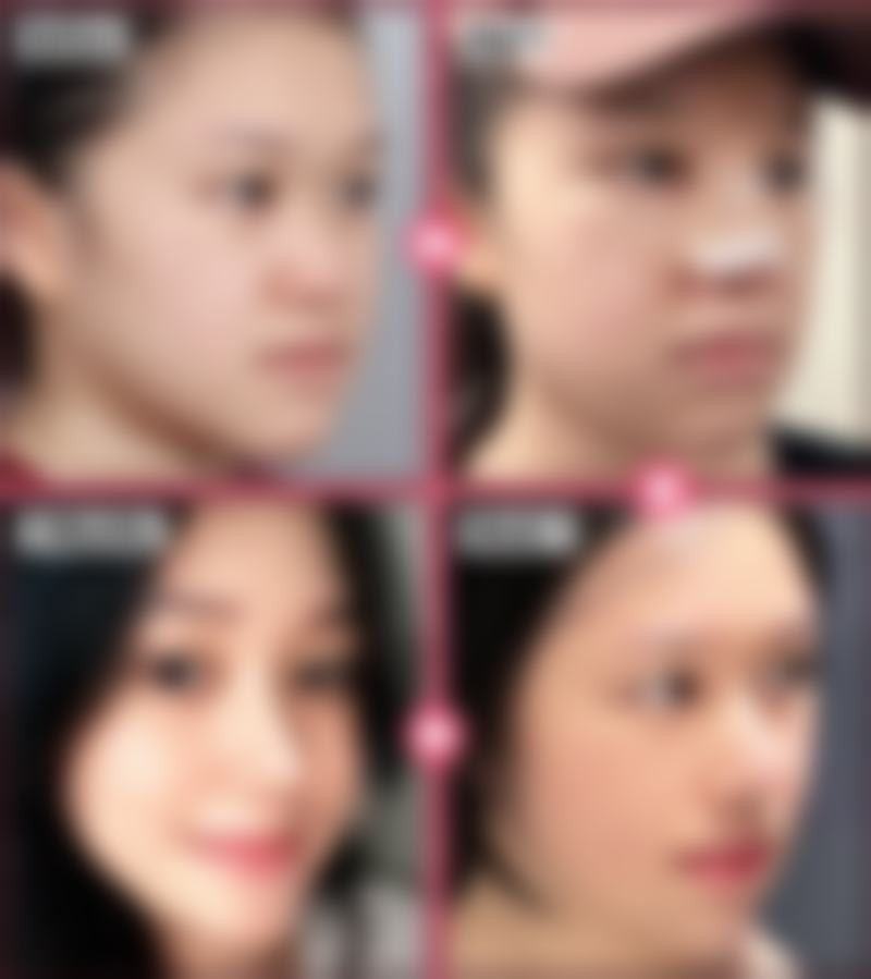 九、巴中巴州依韩尚美整形医院口碑与评价