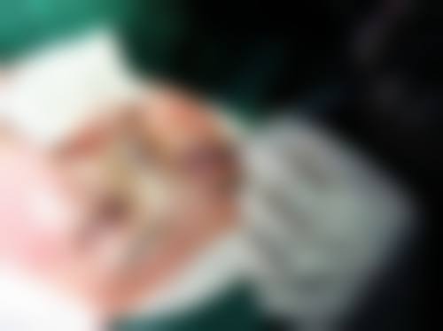 八、适合进行埋线双眼皮修复的人群