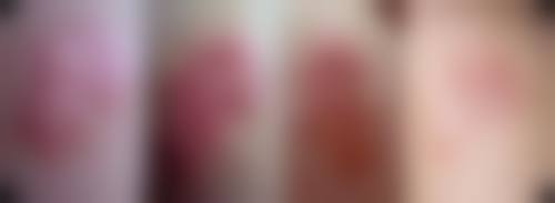 六、深圳星玮整形医院收费参考与价格区间