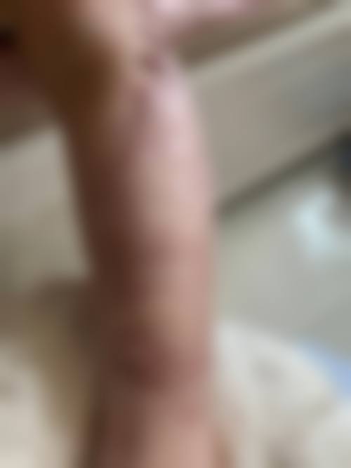 不同疤痕类型的修复周期是怎样的