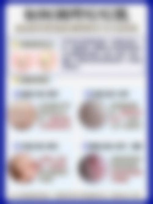 四、张玲玉医生做手术价格