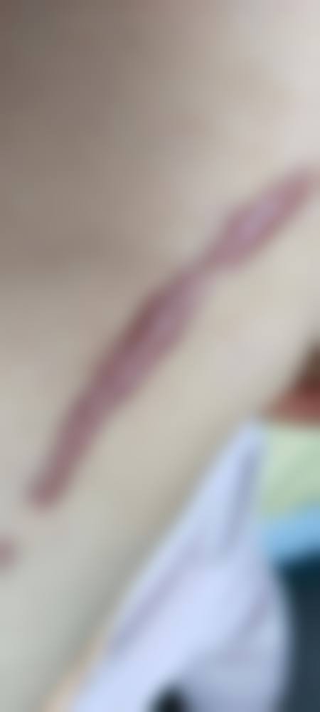 九、北京唯医整形医院患者常见问题解答（精选 ）