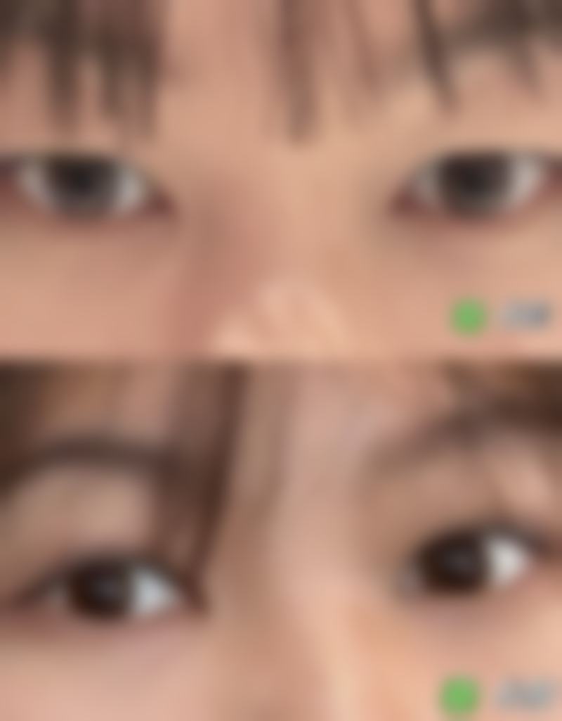 五、如何通过3步自测眼型与脸型匹配度，看自己适不适合双眼皮？