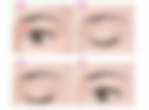 全切双眼皮和韩式三点哪个好？专家解析3大区别+价格对比，选对美眼不踩坑！