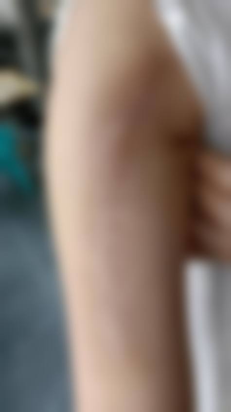 三、新晃玖悦整形医院国有私立性质