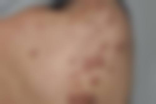 八、患者常见问题解答（精选 ）